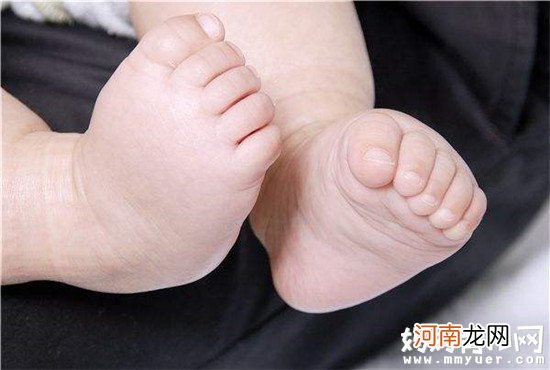 宝宝脚上长红点的3大原因逃不了 看看你家宝宝是哪一个