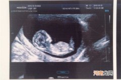 12周胎儿nt数据看男女 孕12周nt1.3mm男孩女孩