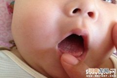 2个月宝宝舌苔厚白是怎么回事 宝宝舌苔厚白怎么办？