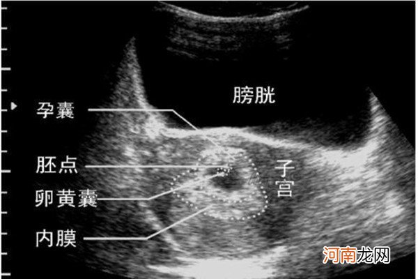 b超图怎么看性别三线 多数宝妈已经验证，特别准！