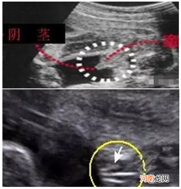 b超看胎儿性别图解 教你怎么从b超图像中看出宝宝性别