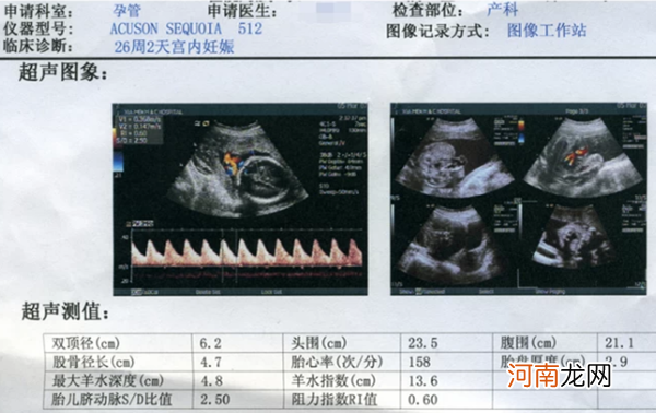 b超看胎儿性别图解 教你怎么从b超图像中看出宝宝性别