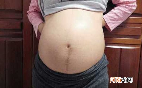 怀孕28周男宝肚型图片 原来怀男孩肚子长这样！