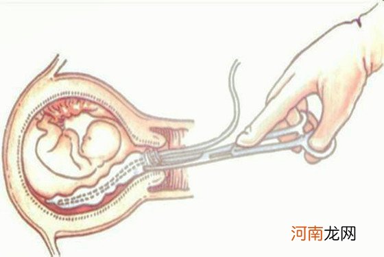 还敢流？怀孕三个月胎儿引产下来图片把我吓傻了