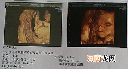 古代孕妇如何生孩子 古代女人生孩子顺产