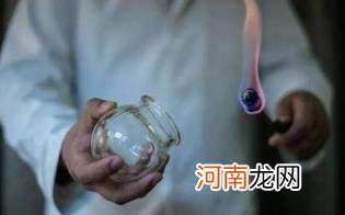 拔罐后需要注意些什么优质