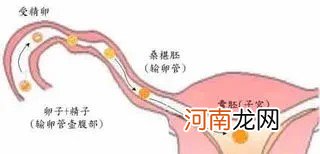 宫外孕后还能自然怀孕吗 宫外孕后还能怀孕吗