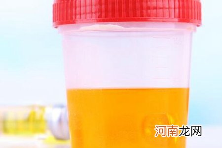 五个症状表现就需要警惕了 肾炎的症状是什么？