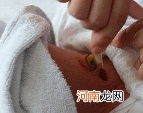 新生儿脐带护理看这篇就够了 超详细图文解说