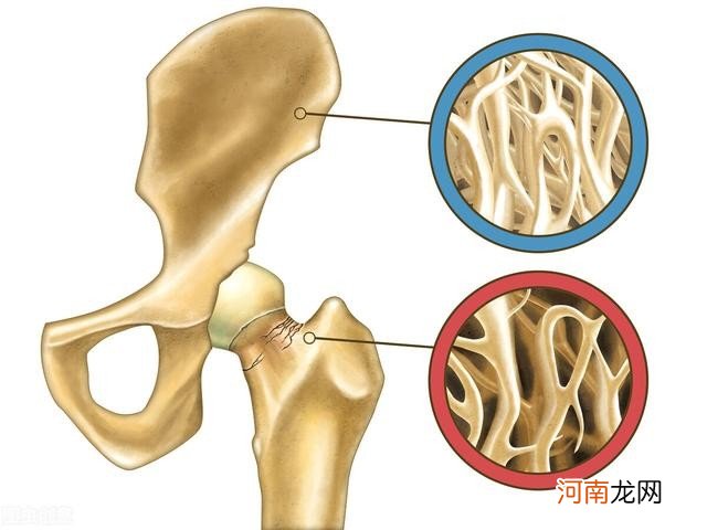 这3个时候补钙效果好 什么时候补钙最好