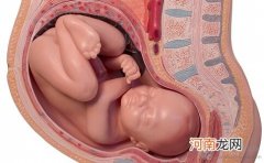 胎儿脐带绕颈 准妈妈该如何应对