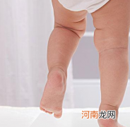 预防宝宝发生O型腿的注意事项