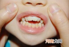 宝宝牙齿不整齐的6个原因