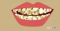 为什么牙齿会发黄 牙齿为什么越来越黄