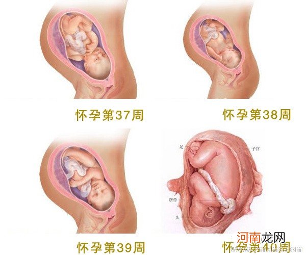 怀孕长副乳了怎么办