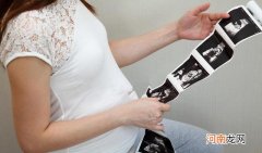 怀孕初期必做的检查 孕早期最关键的5项检查