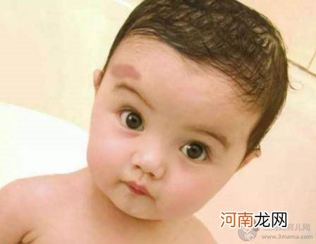 孕妇不能吃哪些食物 孕妇怎么防止孩子胎记