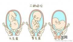 孕晚期怎么调整胎位