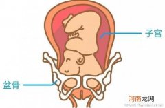孕晚期怎么做快速入盆