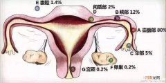 什么是宫外孕？宫外孕哪些症状？哪些人容易宫外孕？