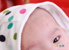 宝宝奶粉过敏如何解决 宝宝奶粉过敏多久能好