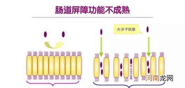 婴儿拉绿屎的原因有哪些 婴儿拉绿屎怎么办