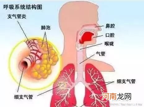 宝宝患支气管炎的常见症状