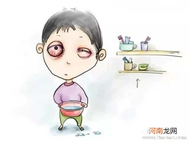 红眼病高发季：如何有效预防