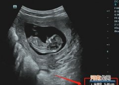 怀孕3个月胎儿 怀孕三个月的胎儿是什么样子的