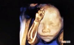 被四维照片丑哭 孕期胎儿的四维图像