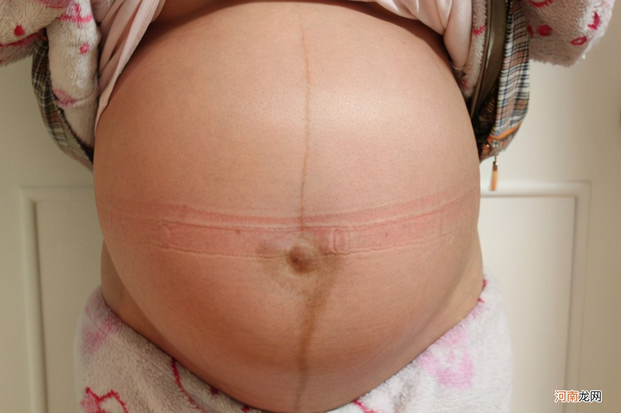 为啥准妈妈腹部有一条黑线？与3个因素有关，好处让人无法拒绝