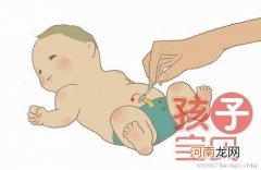 新生儿脐带护理要诀