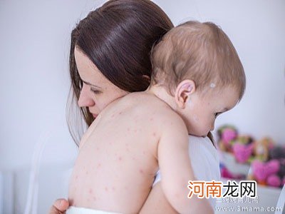 孩子频繁“感冒”或因过敏?