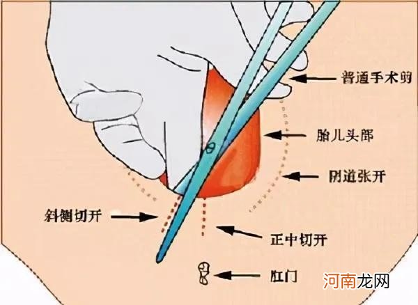 女人生小孩子图 人生孩子需要经历哪些困难