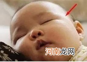 宝宝头骨突出的含义 婴儿枕骨突出怎么回事