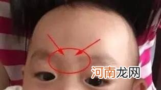 宝宝头骨突出的含义 婴儿枕骨突出怎么回事