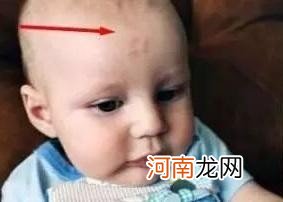 宝宝头骨突出的含义 婴儿枕骨突出怎么回事