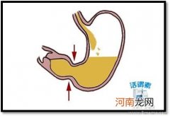 治疗小儿慢性胃炎的食疗妙方