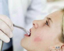 孩子正畸都需要拔牙吗？