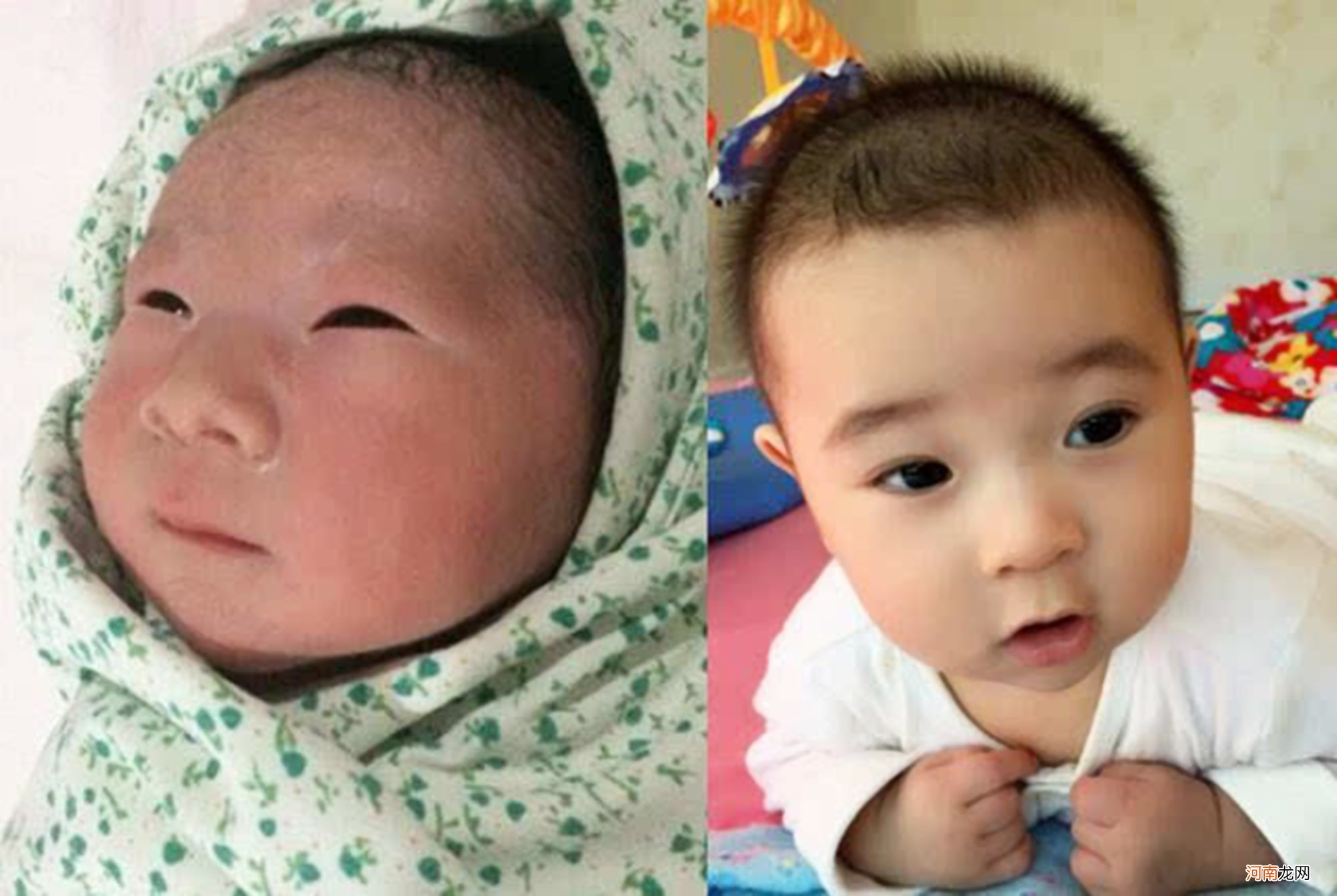 囟门是孩子的“天气预报”？若有这些表现，说明孩子很健康