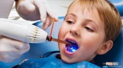 儿童龋齿炎的护理与保健