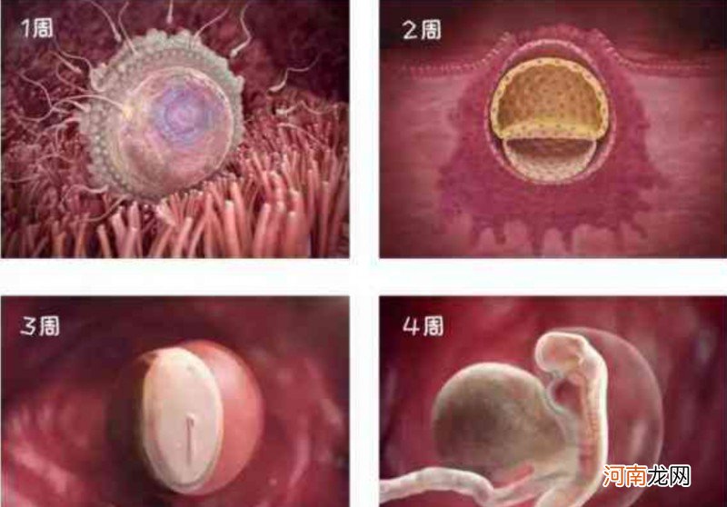 孕早期是流产畸形高发期 孕期健康教育