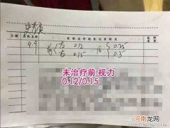 针刺治近视效果如何