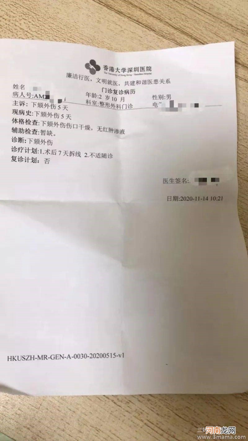 孩子摔伤别一味排斥CT检查