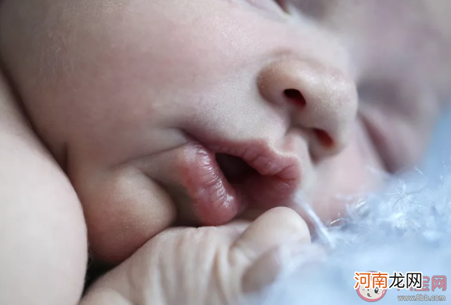 口呼吸贴|口呼吸贴有用吗 孩子口呼吸如何矫正