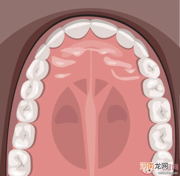 后牙槽|后牙槽上有黑线是什么 窝沟封闭可以预防窝沟龋坏吗