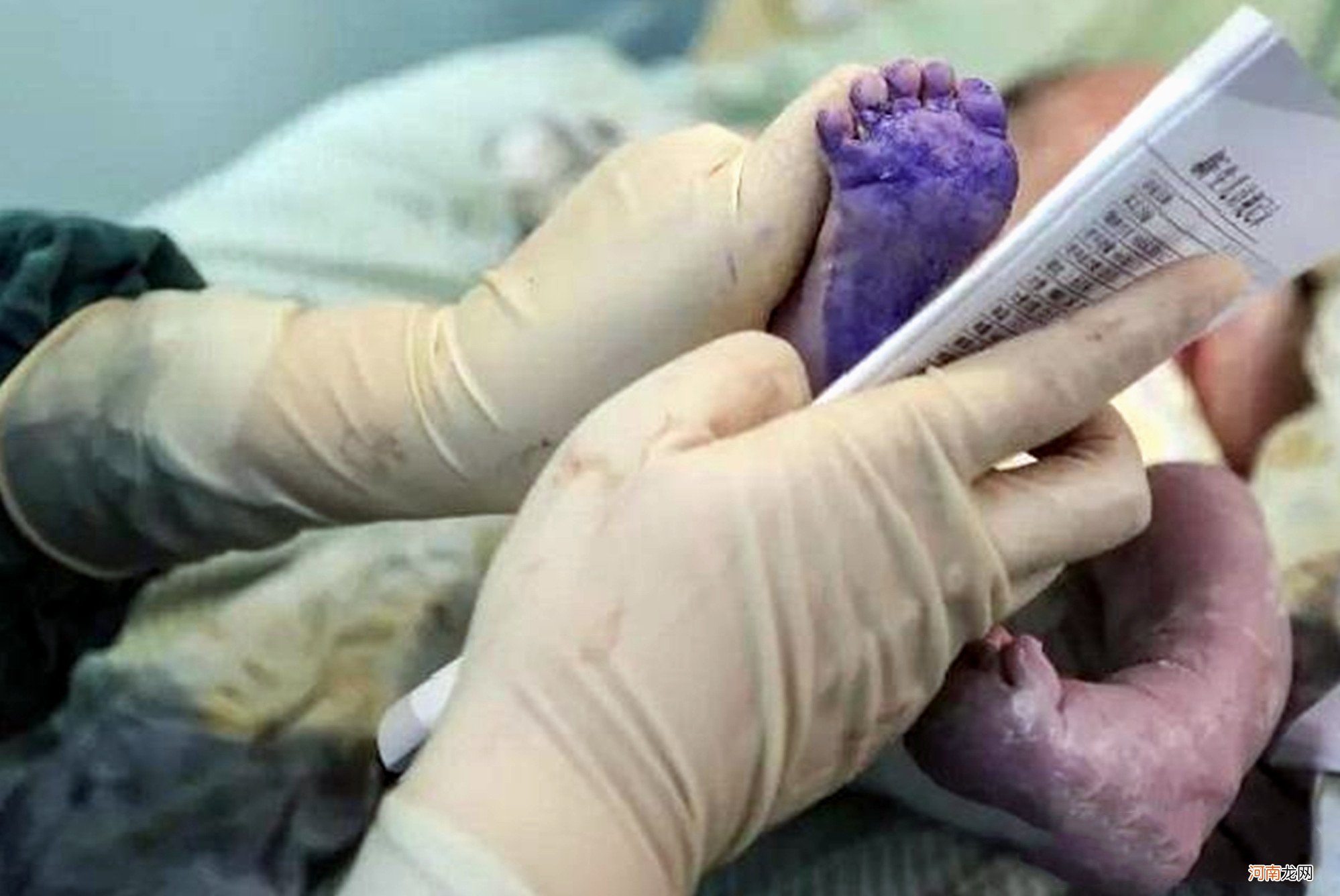 新生儿出生后，医院为什么要采集脚印？别问医生了，提前了解吧