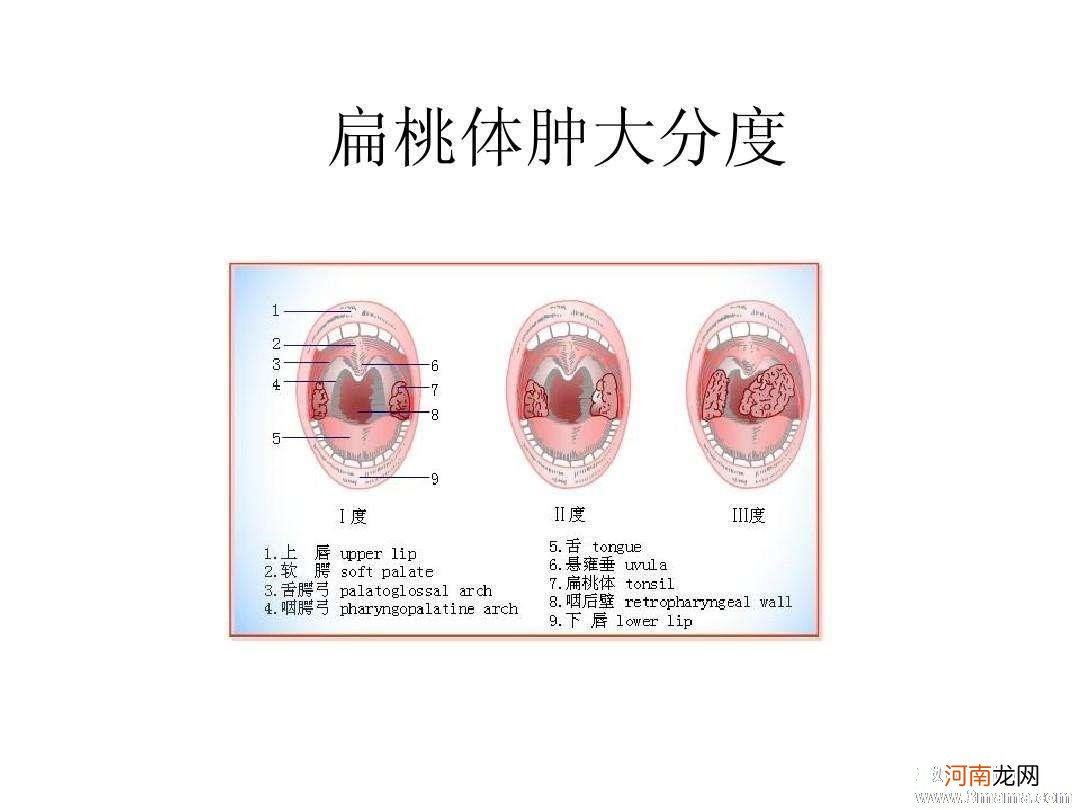 小儿扁桃体手术有禁忌