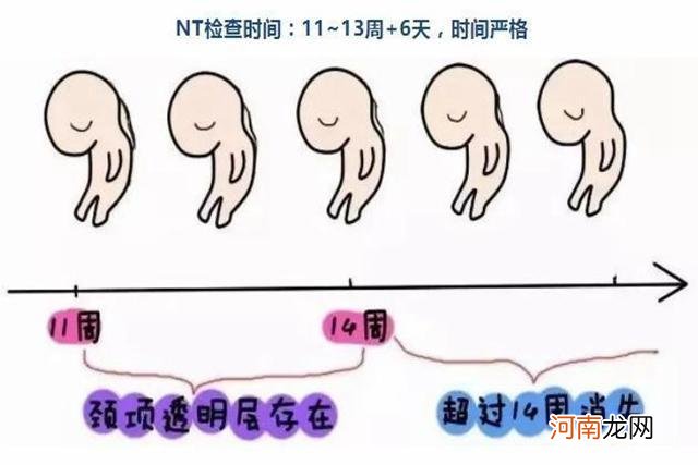 孕期有三项检查顺利通过，孕妇基本可以放心了，说明宝宝很健康