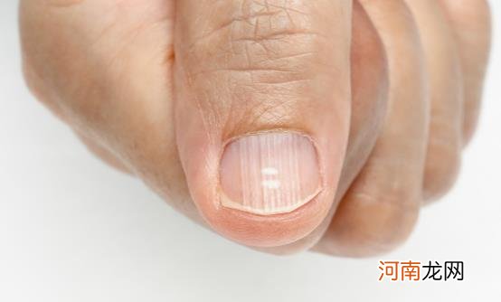 ?指甲保养也是一门学问 如何处理指甲表面不光滑的情况
